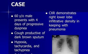 Medical case Study Examples